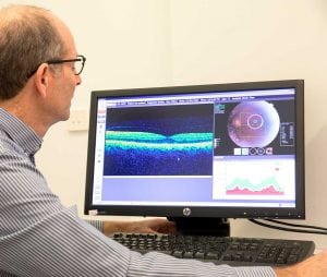 Optical Coherence Tomography diagnosing many eye condition used at Kofsky Optometry