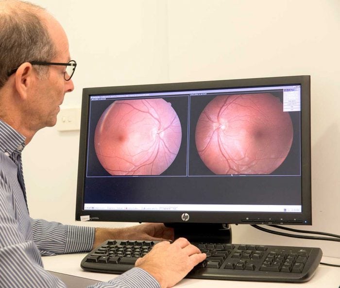 Eye Treatment OrthoK Eye Care Kofsky Optometry