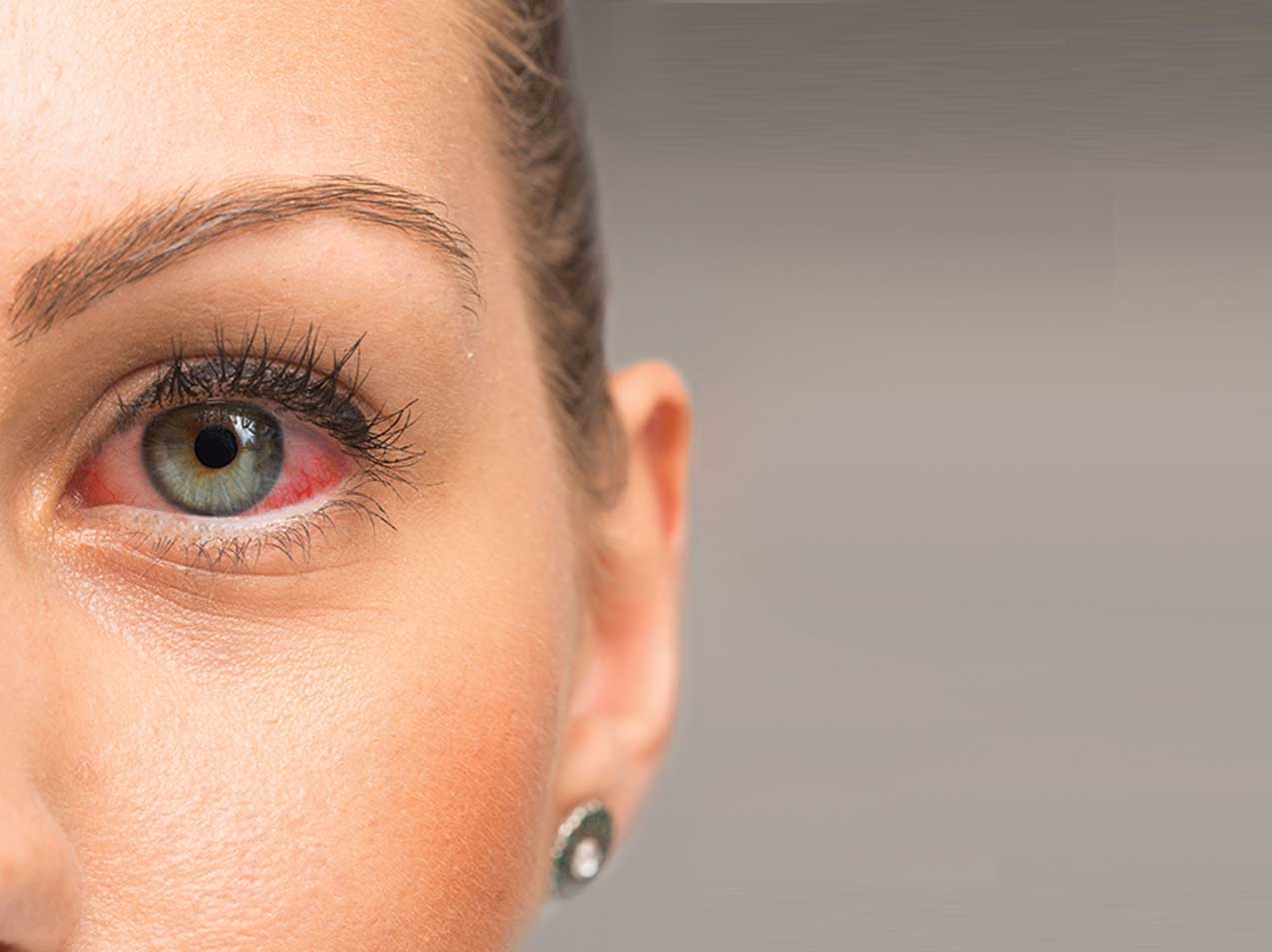 dryeyeredeyes Kofsky Optometry